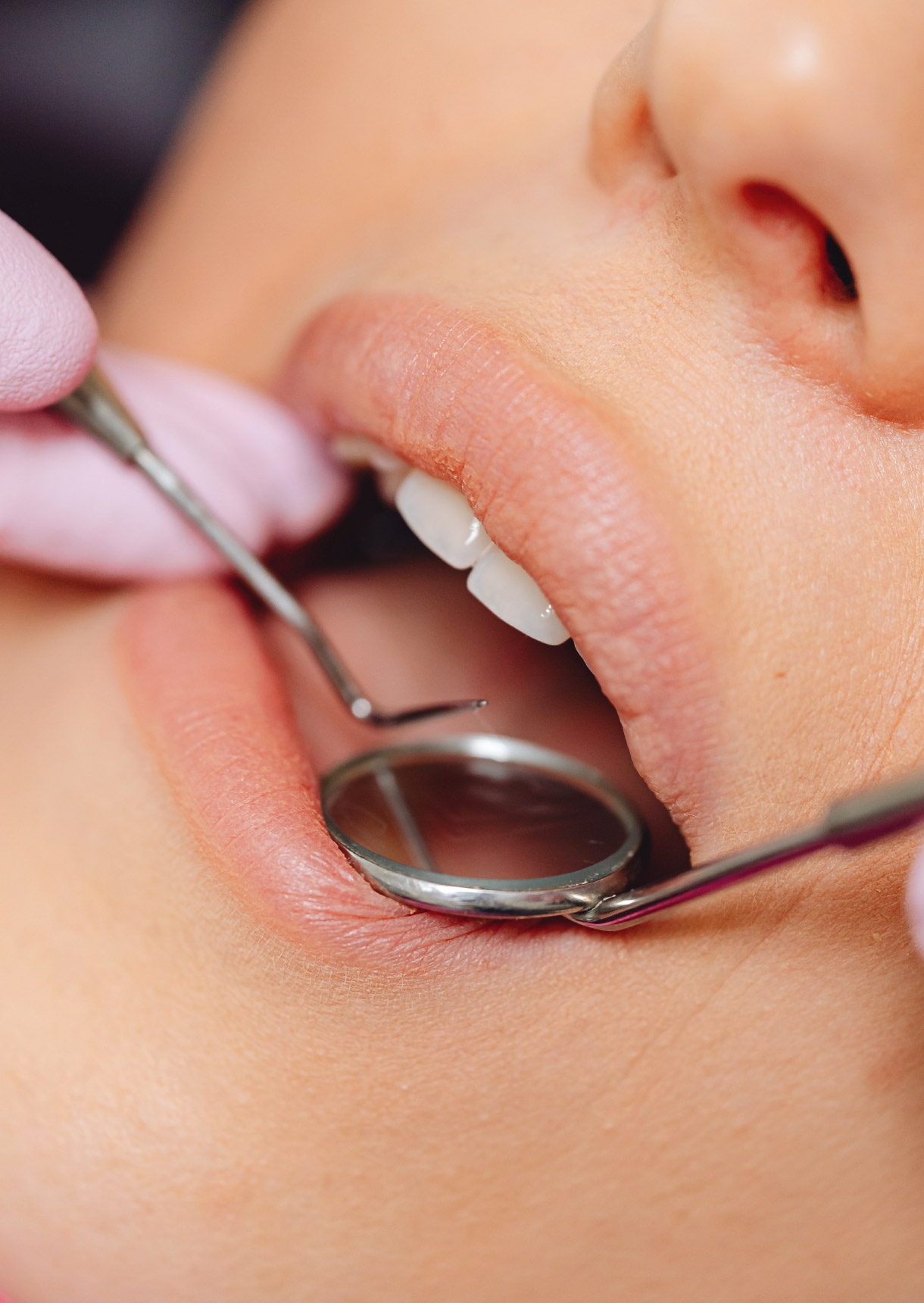 child teeth being inpected